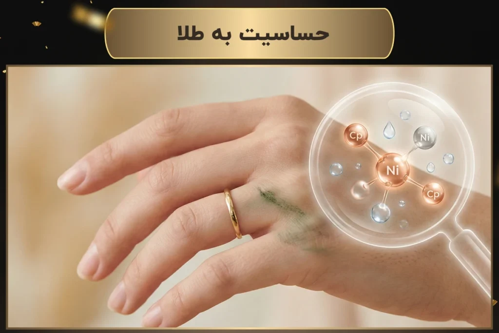 حساسیت به طلا | چرا پوستم با طلا سیاه می‌شود؟