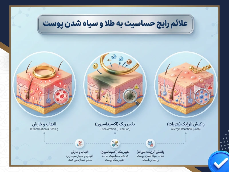 علائم رایج حساسیت به طلا و سیاه شدن پوست